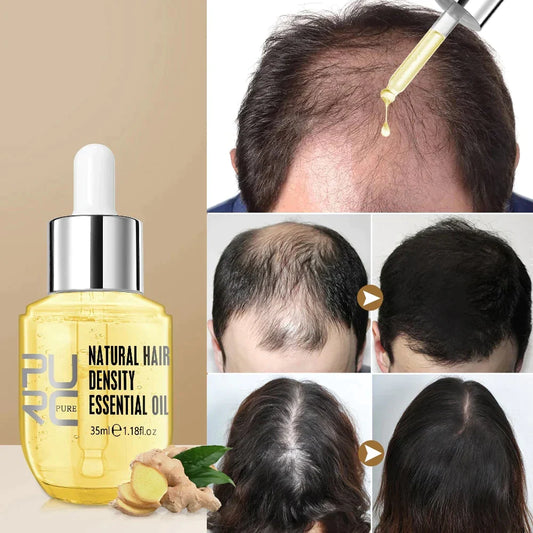 Last Day Promotion 70% OFF - 🔥Hair Growth Serum