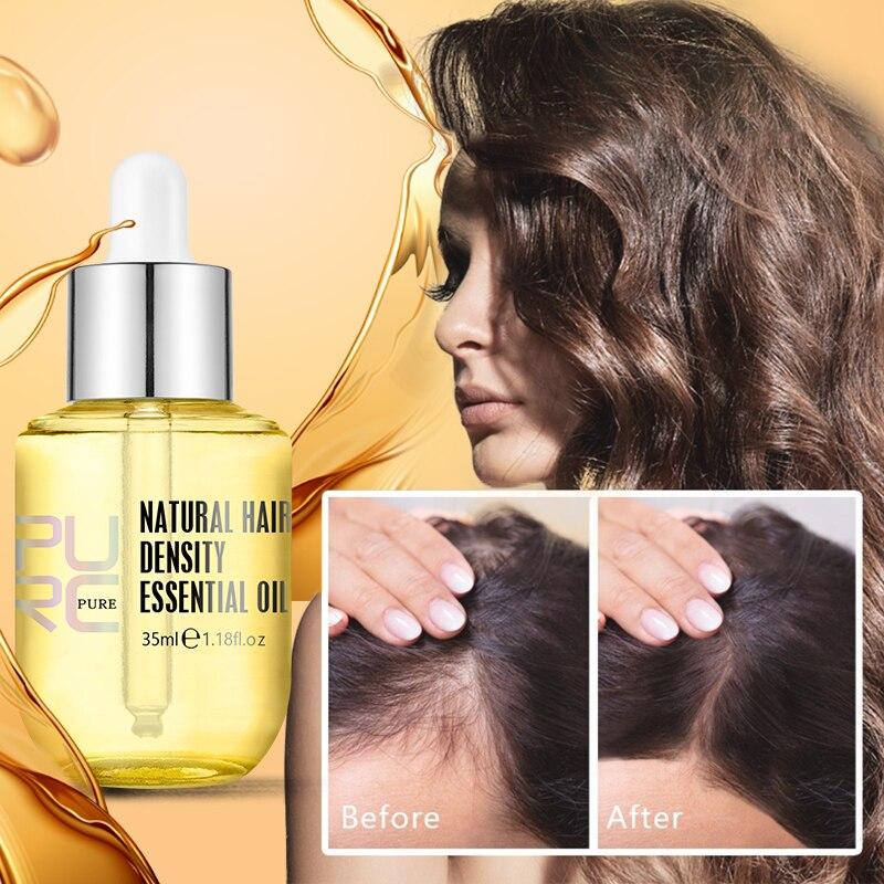 Last Day Promotion 70% OFF - 🔥Hair Growth Serum